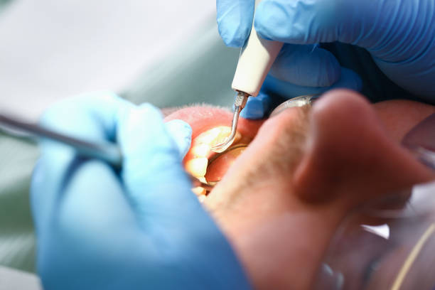 Best Emergency Broken Tooth Repair in Sneads Ferry, NC
